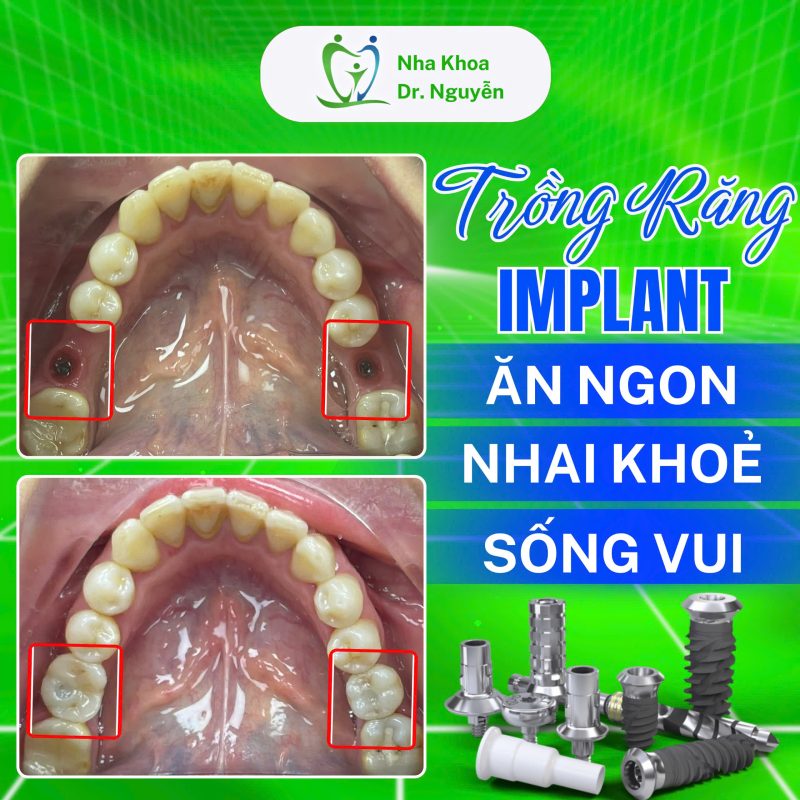 Phòng Khám Nha Khoa Dr Nguyễn