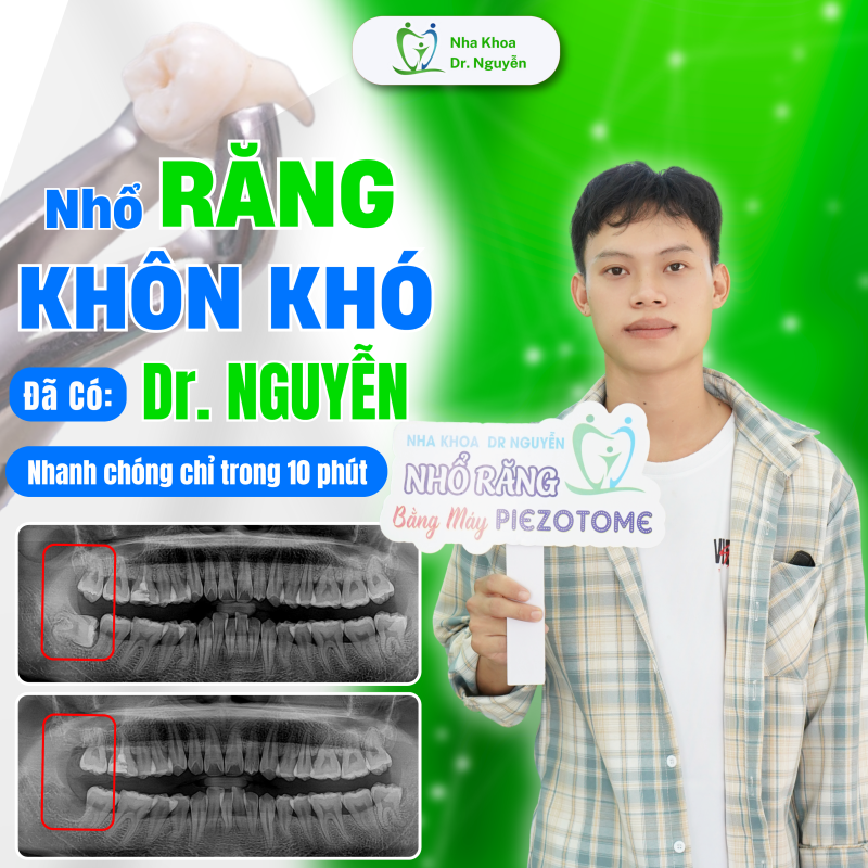 Phòng Khám Nha Khoa Dr Nguyễn