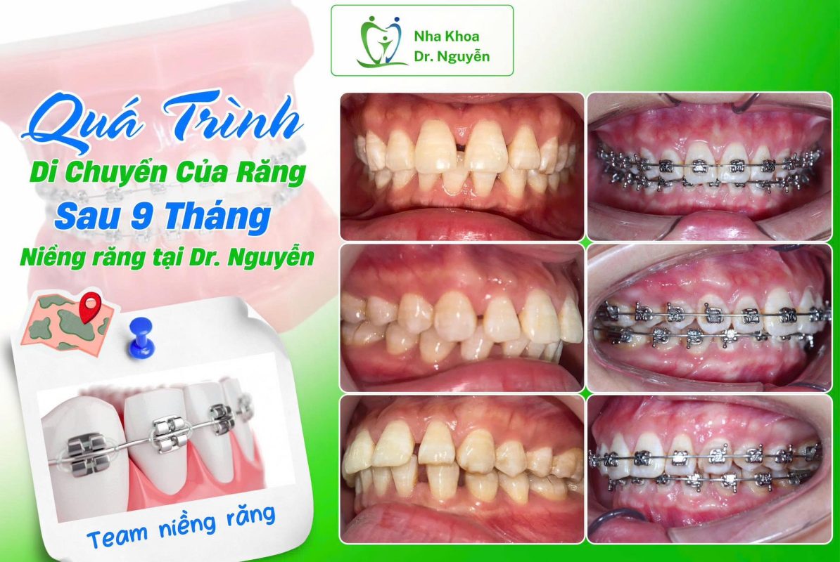 Phòng Khám Nha Khoa Dr Nguyễn