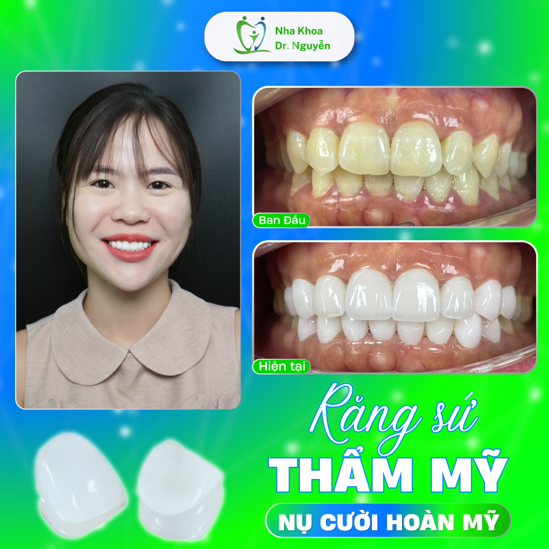 Phòng Khám Nha Khoa Dr Nguyễn