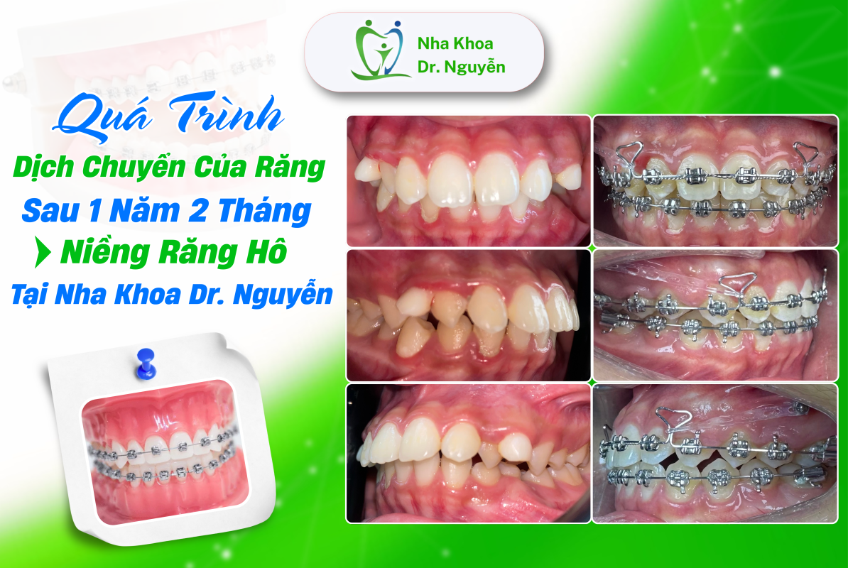 Phòng Khám Nha Khoa Dr Nguyễn
