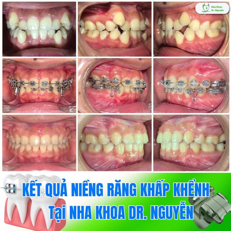 Phòng Khám Nha Khoa Dr Nguyễn