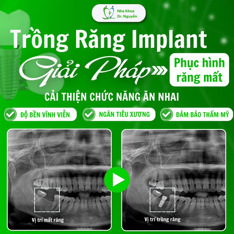 Phòng Khám Nha Khoa Dr Nguyễn
