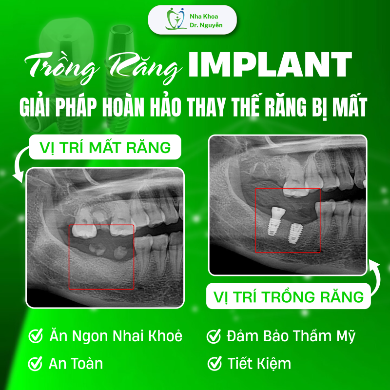 Phòng Khám Nha Khoa Dr Nguyễn