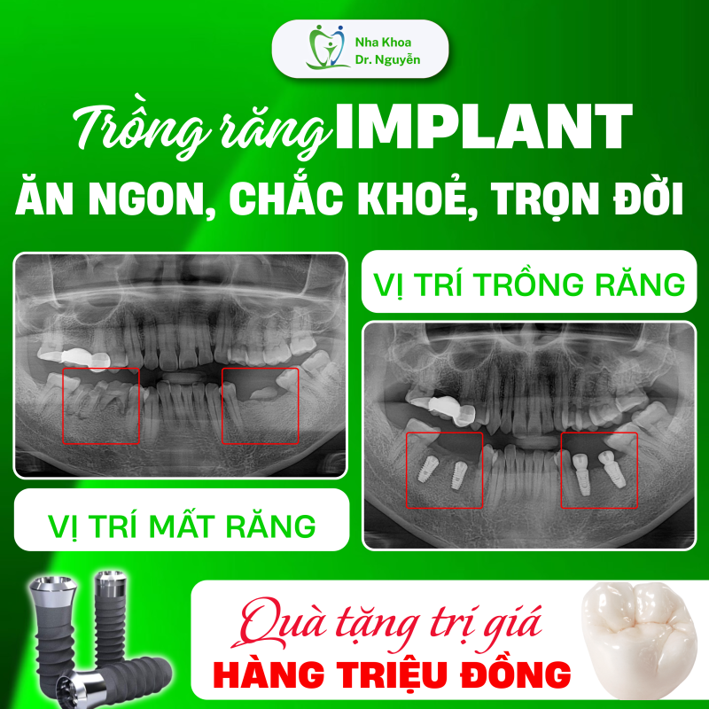 Phòng Khám Nha Khoa Dr Nguyễn